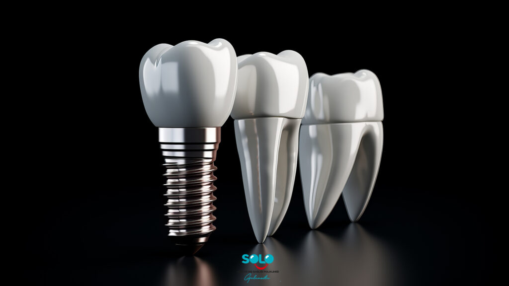 Yerli İmplant Mı Yabancı İmplant Mı?