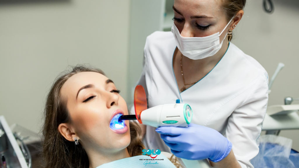 Composite Dental Filling