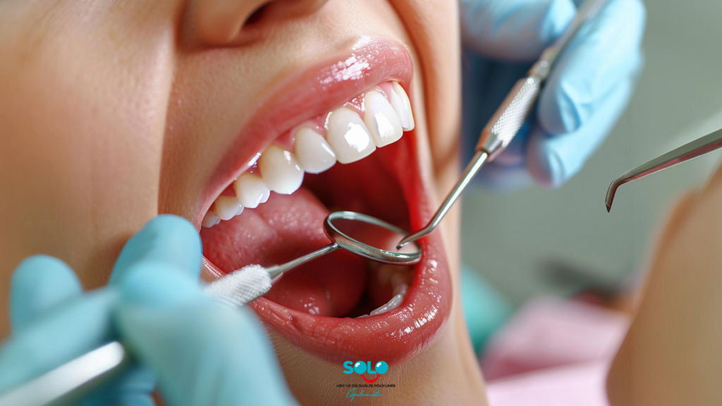 Composite Dental Filling
