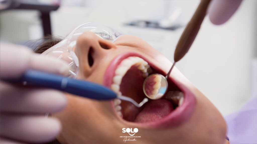 Damak Ağrısı Neden Olur