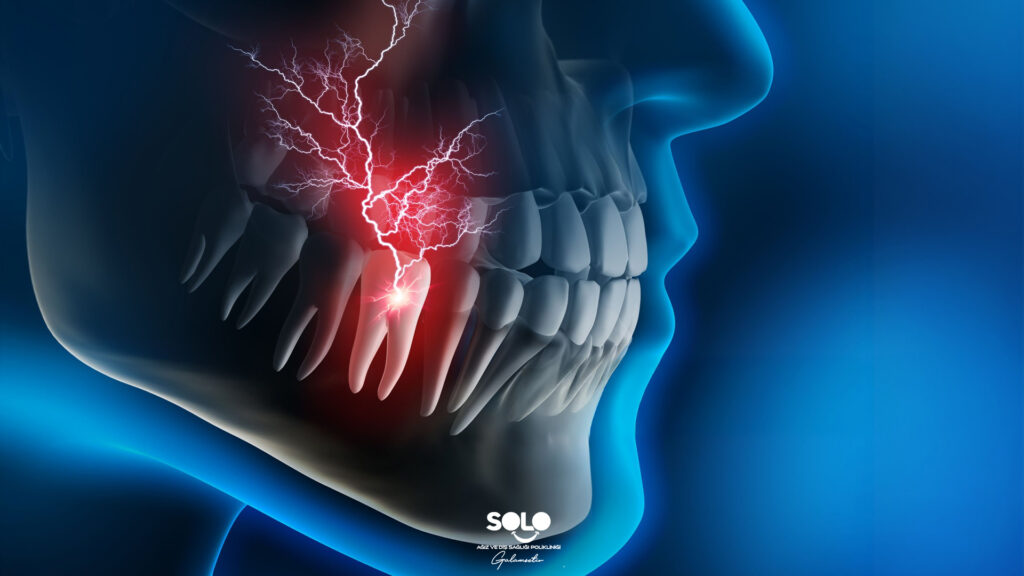 Diş Kökünde Ağrı