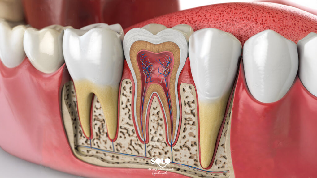 Kanal Tedavisi Sonrası Ağrı