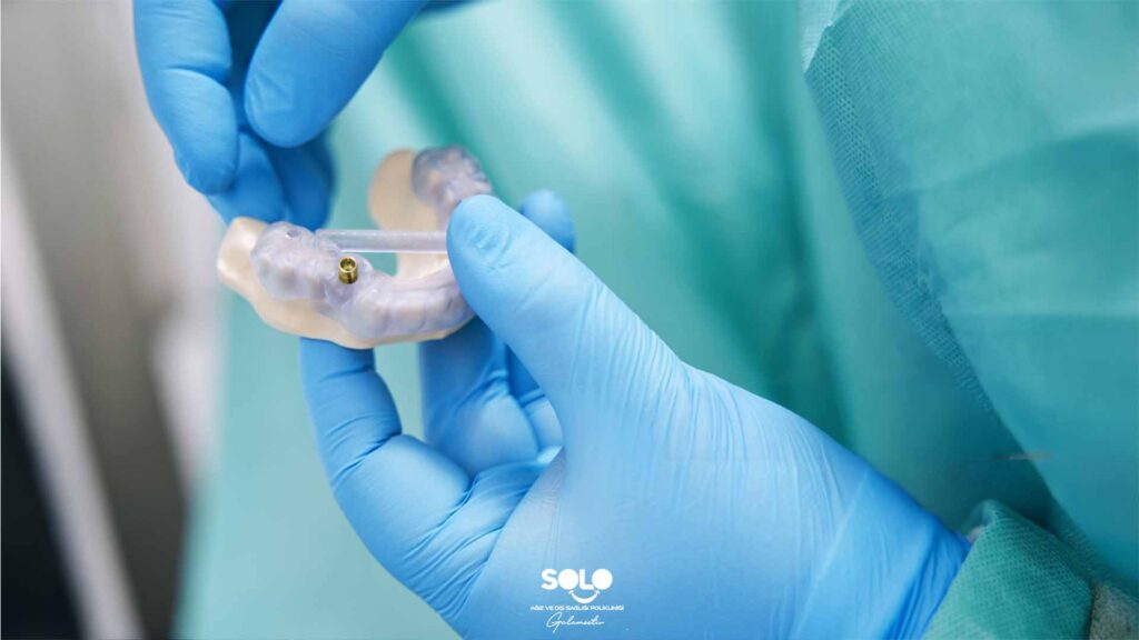 What is a Surgical Guide