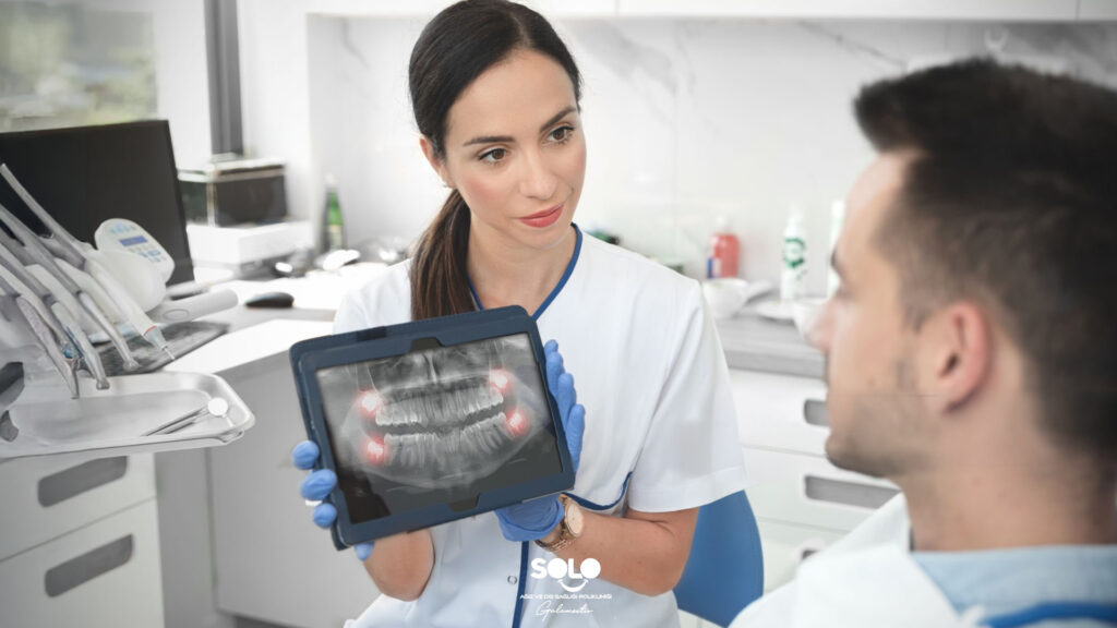 Do Wisdom Teeth Grow Before Age 20