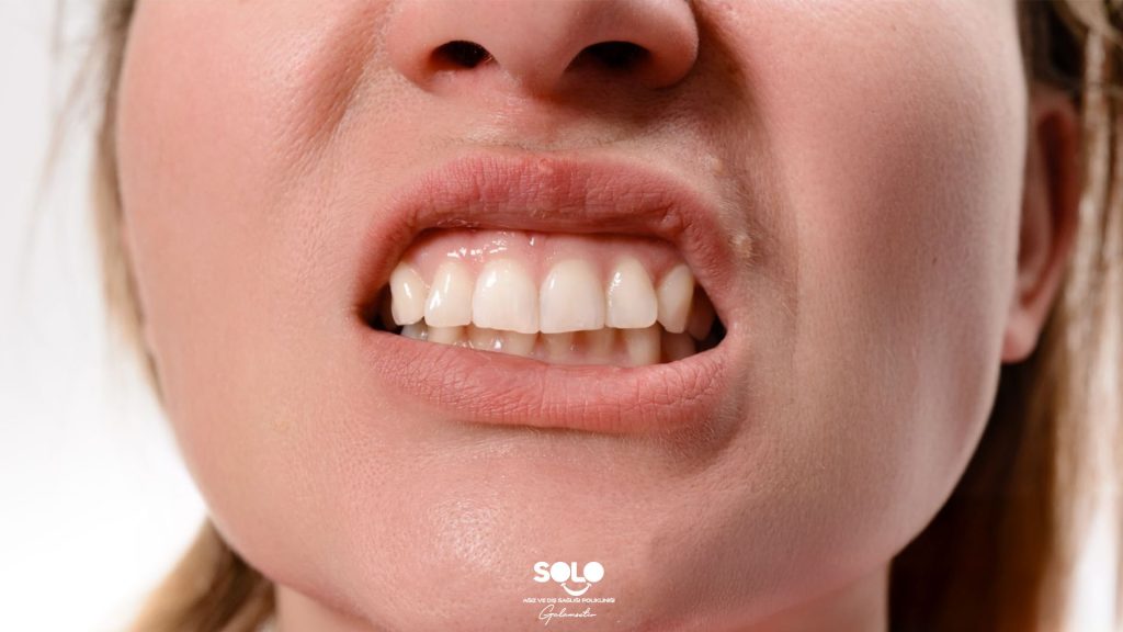 What is Tooth Numbness