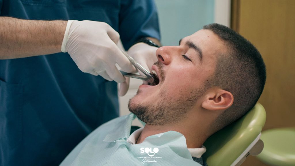 What to Do After Tooth Extraction