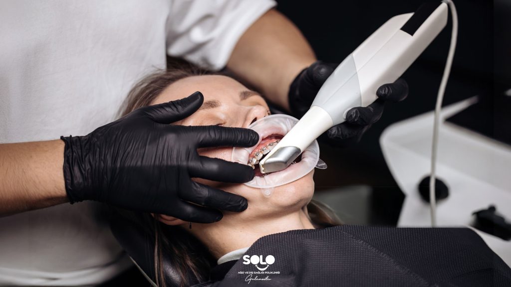 What is Digital Impression