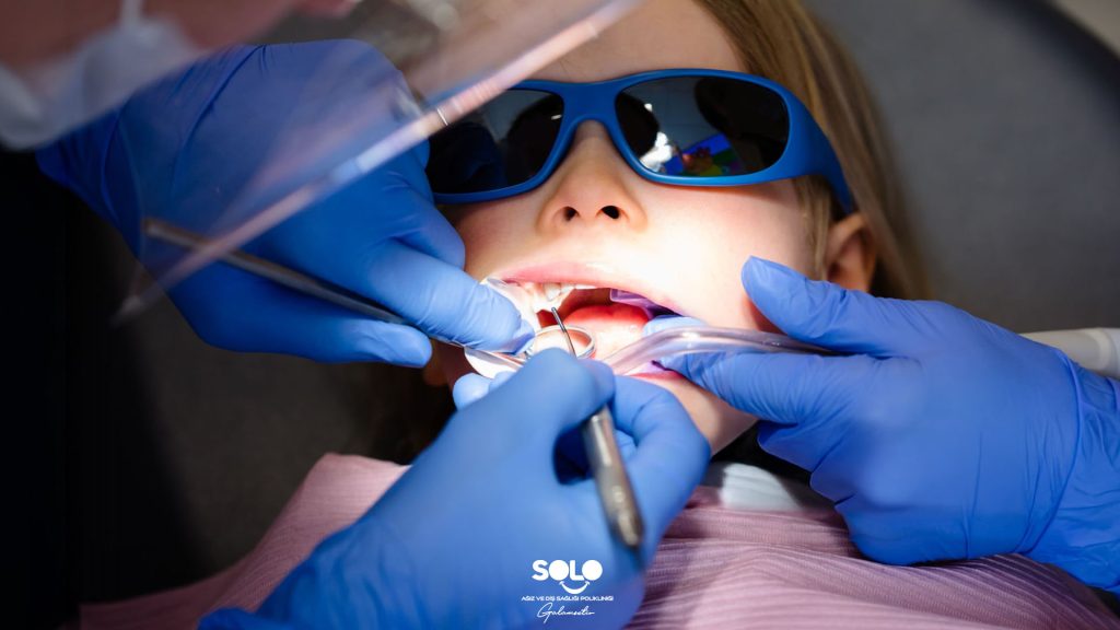 Why Do Baby Teeth Get Cavities